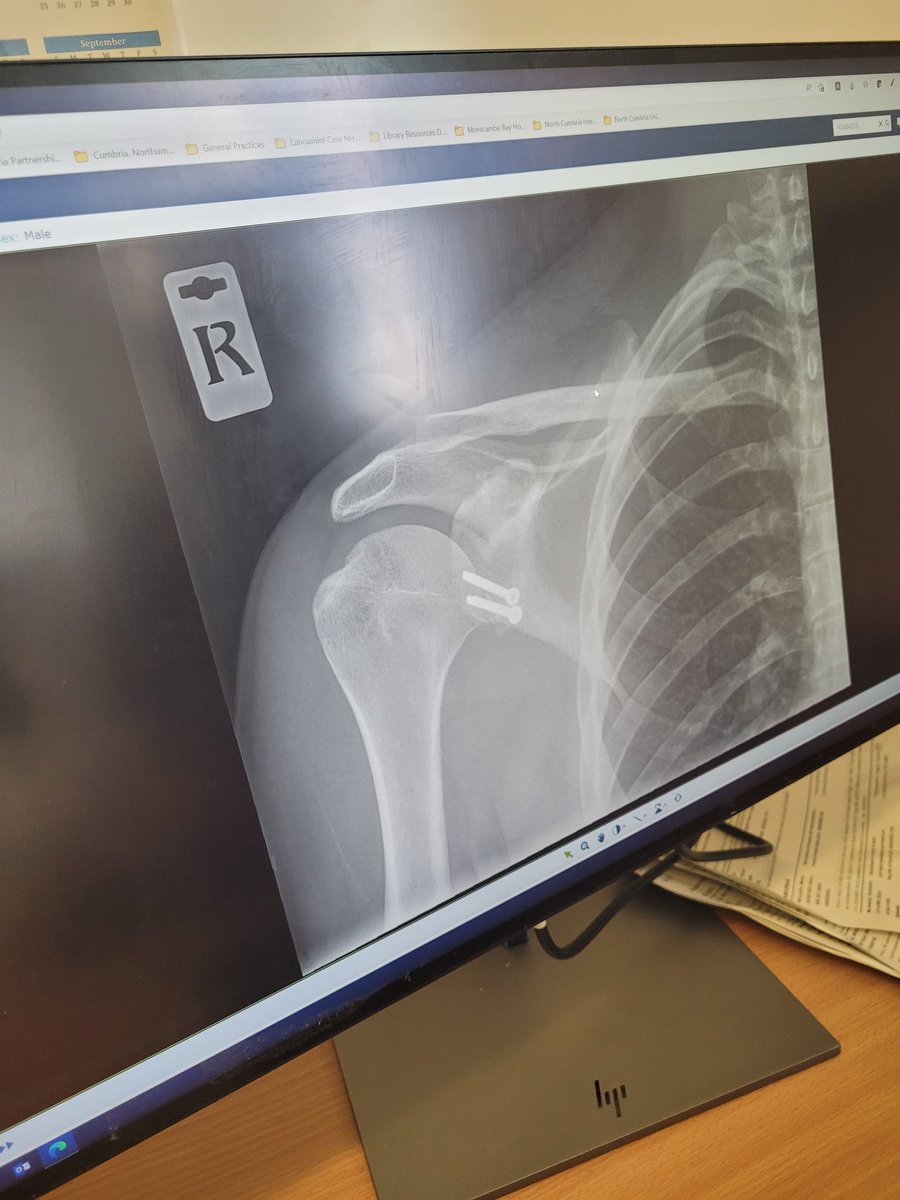 AutoEnki's tweet image. Praying my shoulder stays in place!! 🙏🙏🙏 God bless you all!