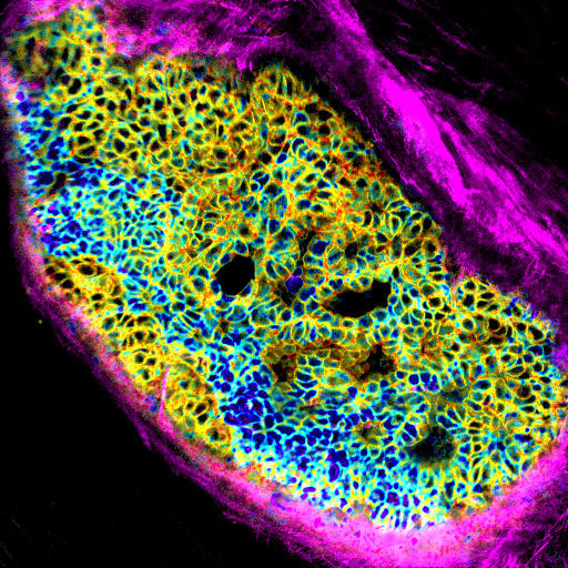 VIB (@viblifesciences) on Twitter photo <a href="/max_nobis_/">Max Nobis</a> at <a href="/_Intravital/">Intravital Imaging Expertise Center</a> developed a new mouse model to study AKT activity in tissues. 🔬 Besides offering funky microscopy images, it can be used to read #AKT activity in proliferating #cancer cells or verify #glucose signaling in a metabolic study. 👇
vibbio.tech/40MZ3O1 <a href="/max_nobis_/">Max Nobis</a> at <a href="/_Intravital/">Intravital Imaging Expertise Center</a> developed a new mouse model to study AKT activity in tissues. 🔬 Besides offering funky microscopy images, it can be used to read #AKT activity in proliferating #cancer cells or verify #glucose signaling in a metabolic study. 👇
vibbio.tech/40MZ3O1
