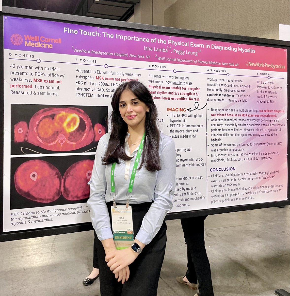 Grateful for the opportunity to present my poster at #SGIM23. This was a case of anti-synthetase syndrome complicated by autoimmune myocarditis - a patient who could’ve likely been diagnosed + treated much sooner, had a thorough MSK exam been performed at his initial visit.