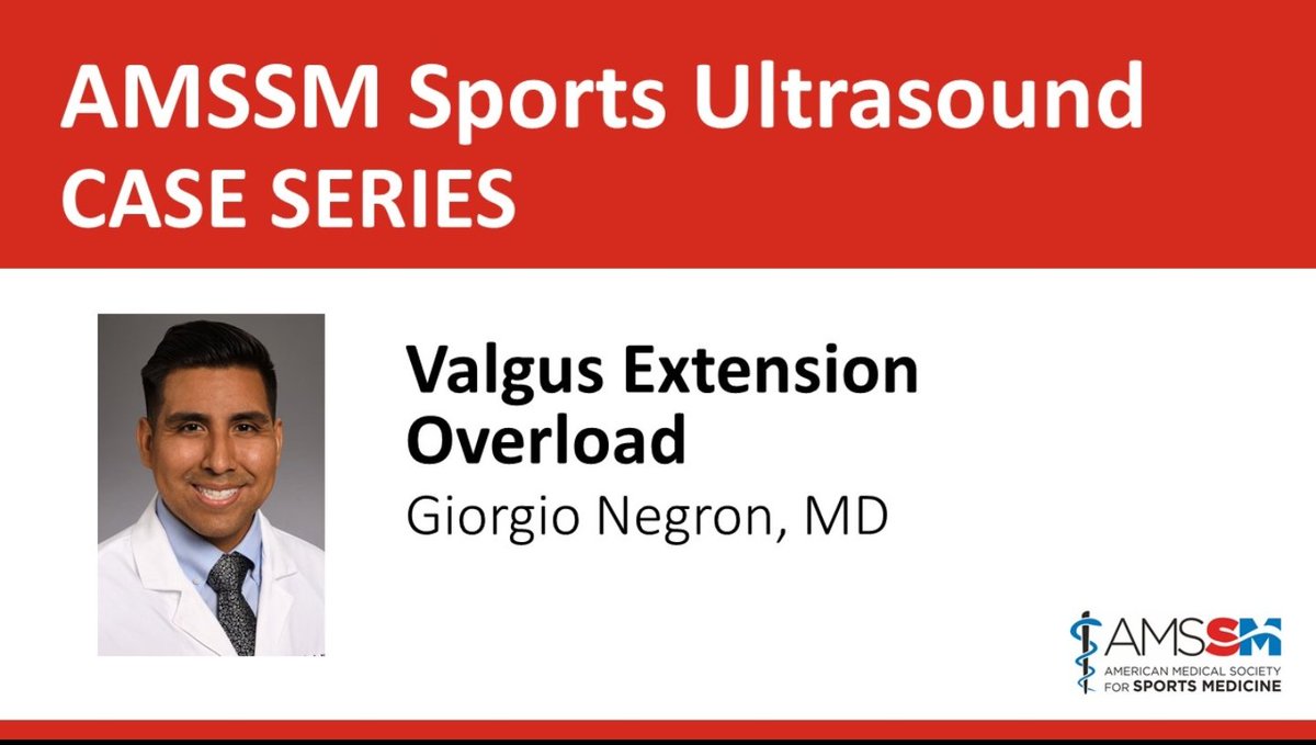 Giorgio Negron, MD, RMSK (@giorgionegronmd) on Twitter photo What a fantastic opportunity to be a part of the AMSSM Ultrasound Case Series.
Thank you <a href="/TheAMSSM/">AMSSM</a> and <a href="/BBoettcherDO/">Brennan Boettcher DO</a> for the invite!
Check out my presentation on valgus extension overload syndrome!
#sportsmedicine #mskultrasound <a href="/mayoclinicsport/">Mayo Clinic Orthopedics and Sports Medicine</a> What a fantastic opportunity to be a part of the AMSSM Ultrasound Case Series.
Thank you <a href="/TheAMSSM/">AMSSM</a> and <a href="/BBoettcherDO/">Brennan Boettcher DO</a> for the invite!
Check out my presentation on valgus extension overload syndrome!
#sportsmedicine #mskultrasound <a href="/mayoclinicsport/">Mayo Clinic Orthopedics and Sports Medicine</a>