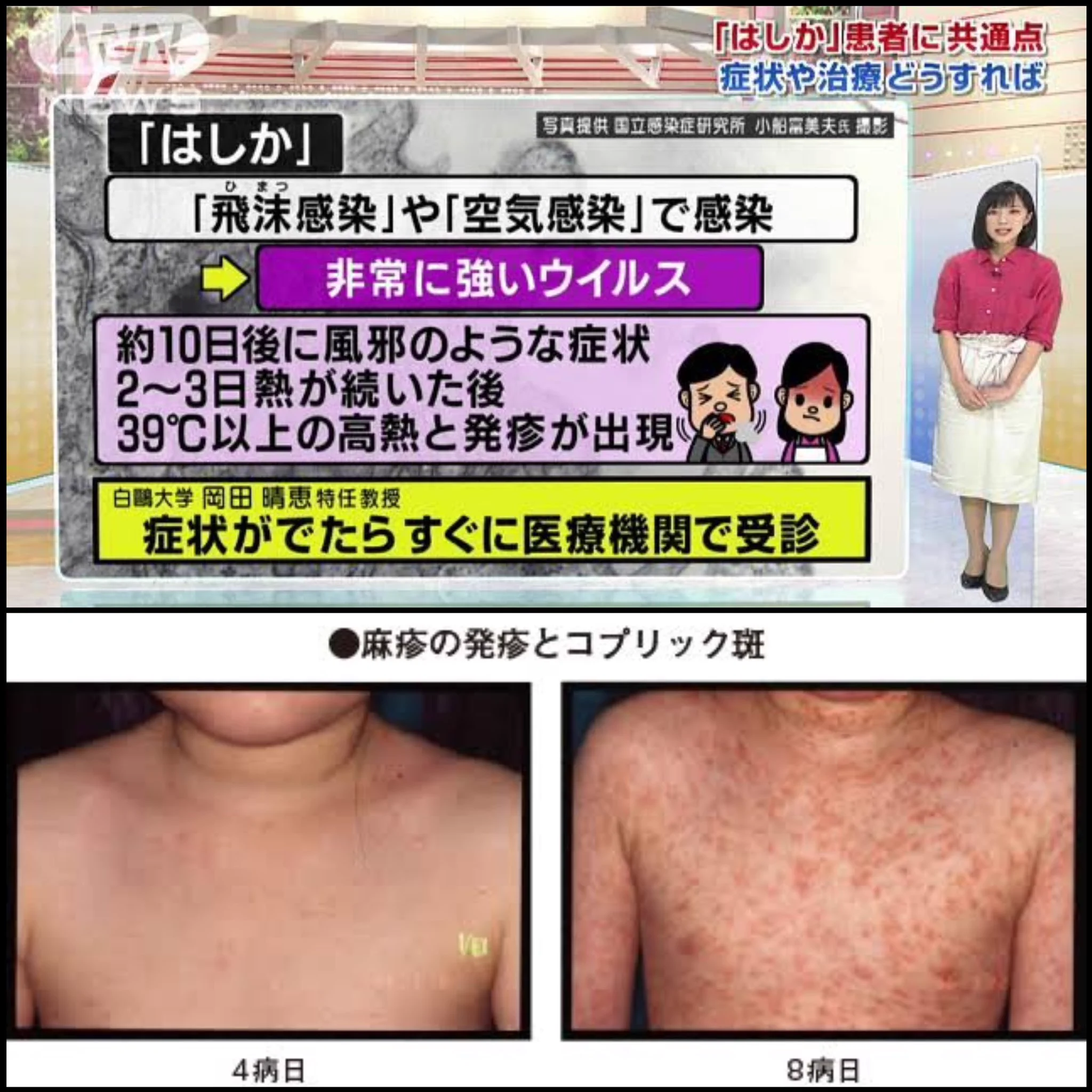 GW中新幹線に乗ったヒトは全員見て！｢麻疹｣のアウトブレイクが来る！？
