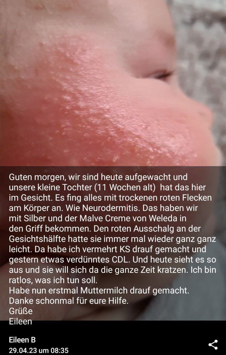 WIR BRAUCHEN DEINE UNTERSTÜTZUNG‼️

ES GEHT UM SKRUPELLOSE GESCHÄFTEMACHER AUF TELEGRAM DIE ELTERN &amp; TIERBESITZERN DAZU RATEN CHLORBLEICHE LÖSUNGSMITTEL UND SONSTIGE CHEMIKALIEN IHREN LIEBSTEN EINZUFLÖSSEN

WIR STARTEN BALD DIE MISSION: GENICKBRUCH UND BRAUCHEN DAFÜR DEINE HILFE