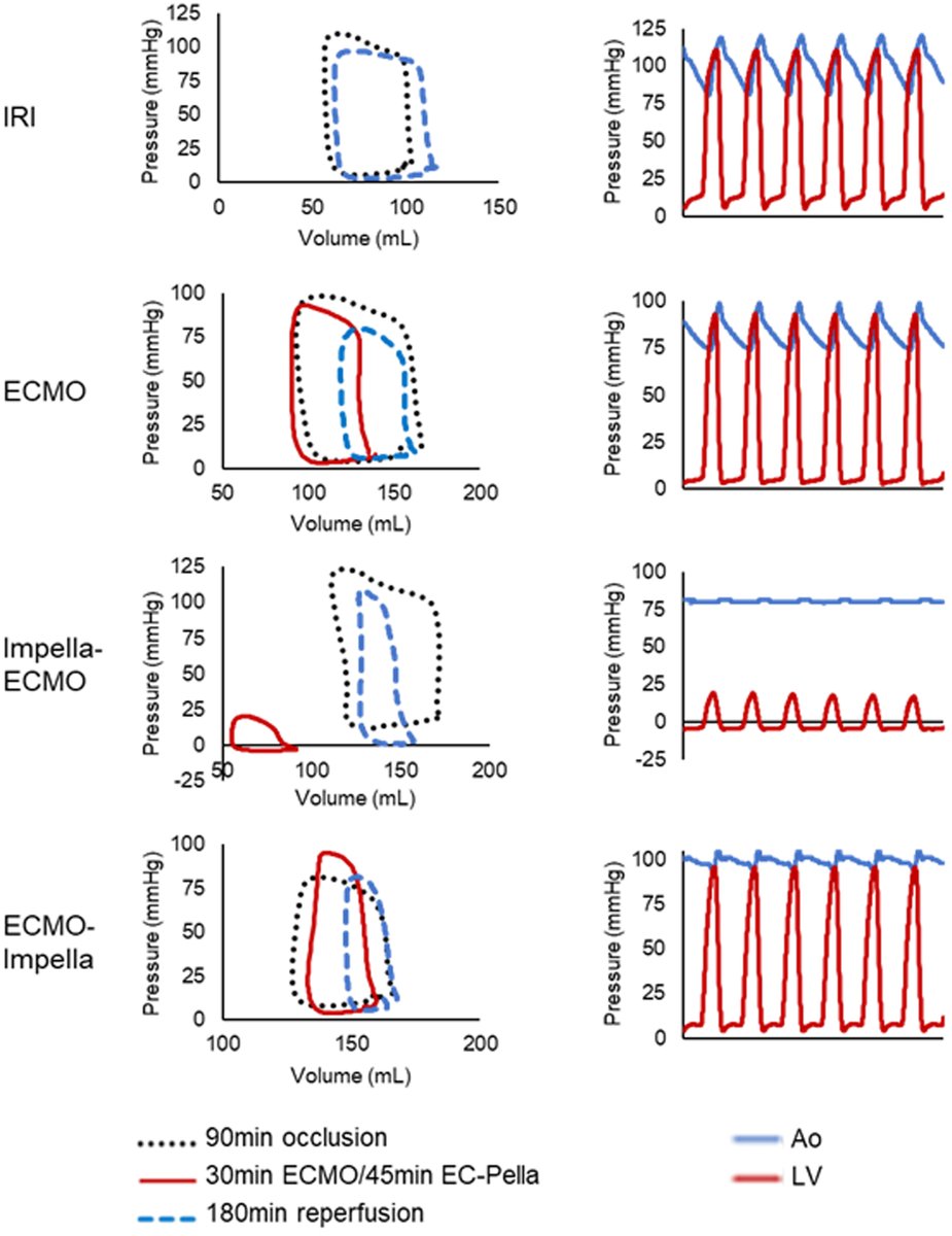 Kay Everett, MD, PhD (@kayeverettmdphd) on Twitter photo What are the mechanisms of LV unloading on #VAECMO in #AMI? Our research published <a href="/JACCJournals/">JACC Journals</a> highlights 1) importance of timing of unloading for PVA reduction, 2) improved cardioprotective signaling and 3) infarct reduction in a preclinical AMI model with #ECPella vs ECMO. What are the mechanisms of LV unloading on #VAECMO in #AMI? Our research published <a href="/JACCJournals/">JACC Journals</a> highlights 1) importance of timing of unloading for PVA reduction, 2) improved cardioprotective signaling and 3) infarct reduction in a preclinical AMI model with #ECPella vs ECMO.