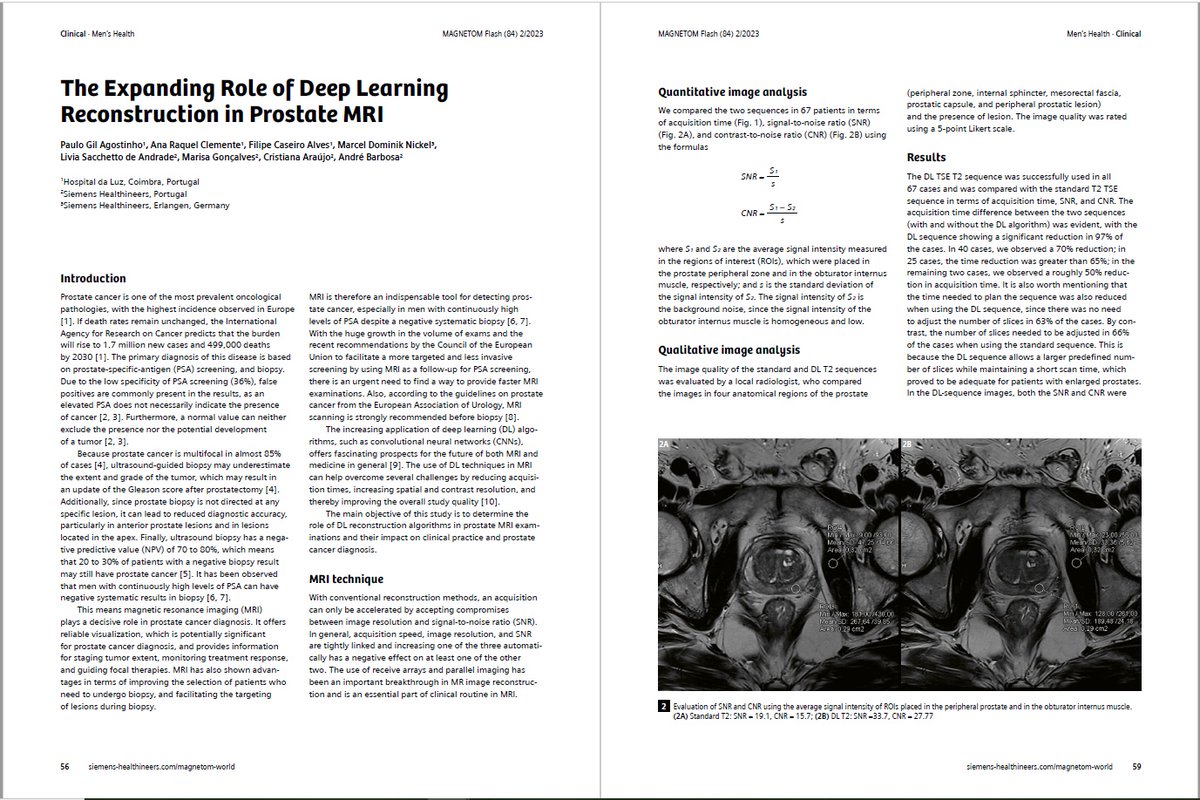 The Expanding Role of #DeepLearning Reconstruction in T2 TSE Prostate #MRI by Dr. Paulo Gil Agostinho; Dr. Filipe Caseiro Alves; (Hospital da Luz, Coimbra, Portugal); @geekmri (@SiemensHealth) et al. 
Learn more …ng.webassets.siemens-healthineers.com/ec0fea037e6d7a…
#magnetomworld #prostatecancer #aiforhealth