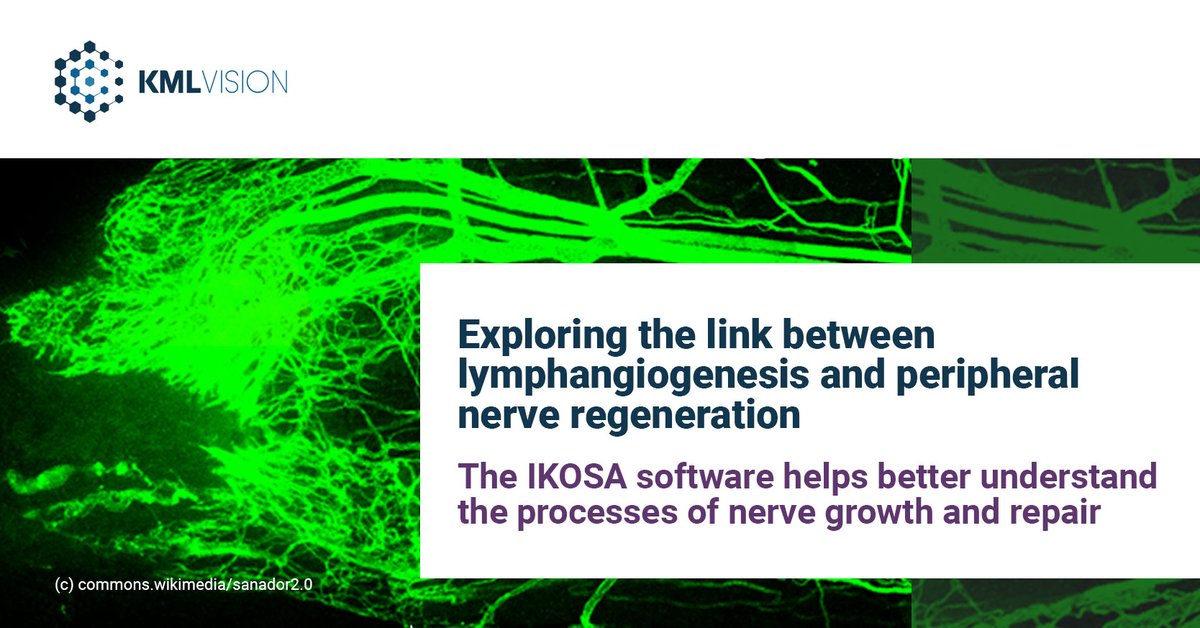 Recent findings highlight the role of lymphangiogenesis in peripheral nerve regeneration. Find out what role IKOSA played in this study: bit.ly/3pdeSQN #KMLVision #IKOSA #neuroscience #lbitrauma #TechnikumWien #TissueRegAustria #MedUniVienna #UniTübingen