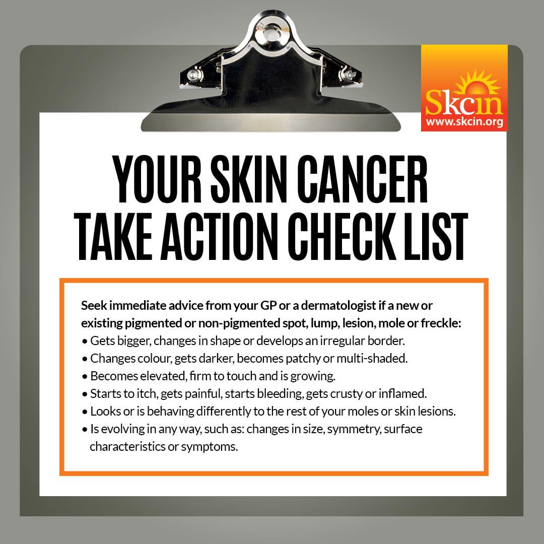 Would you know the signs and symptoms of skin cancer? This handy check list from <a href="/SkcinCharity/">Skcin</a>  shows you some of the things to look out for. #SkinCancerAwareness <a href="/HNYCancer/">Humber and North Yorkshire Cancer Alliance</a> #SkinCancerAwarenessMonth