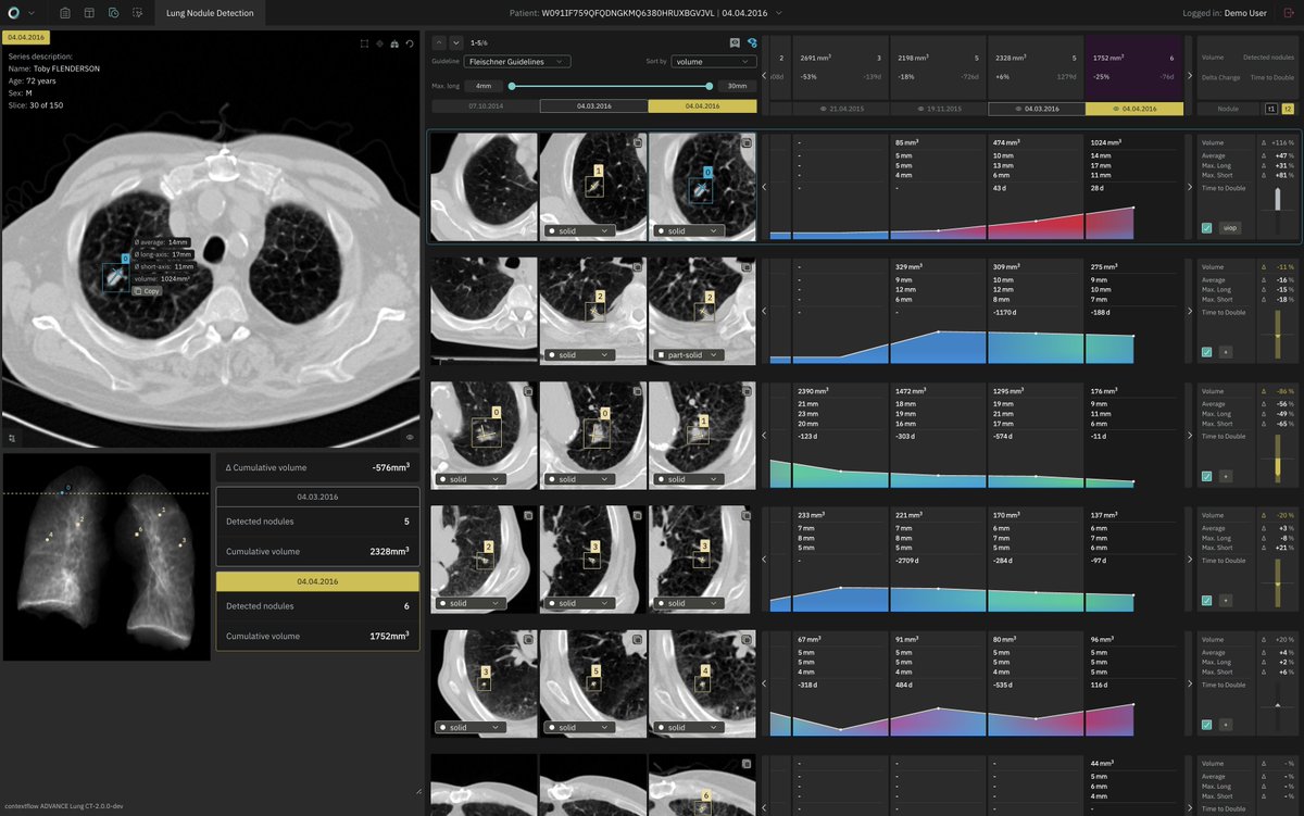 contextflow_rad's tweet photo. 🇫🇮 Helsinki calling! Join #contextflow at the Nordic Congress of Radiology May 24-26. We're so excited to show the latest version of ADVANCE Chest CT with you, particularly our TIMELINE feature, which helps track changes in nodules over time 🕗
Visit us https://t.co/xr0uSoZyw0 https://t.co/a6nlvDsDE5