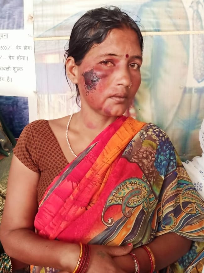 चमार है क्या कर लेगी - जरा गौर कीजिए

गोरखपुर :दलित  महिला को चौकी इंचार्ज कुंवर गौरव सिंह ने घर में घुसकर लाठी से पिट पीटकर महिला को बुरी तरह लहूलुहान किया ,
महिला की आप बीती सुनकर आपके होश उड़ जायेंगे