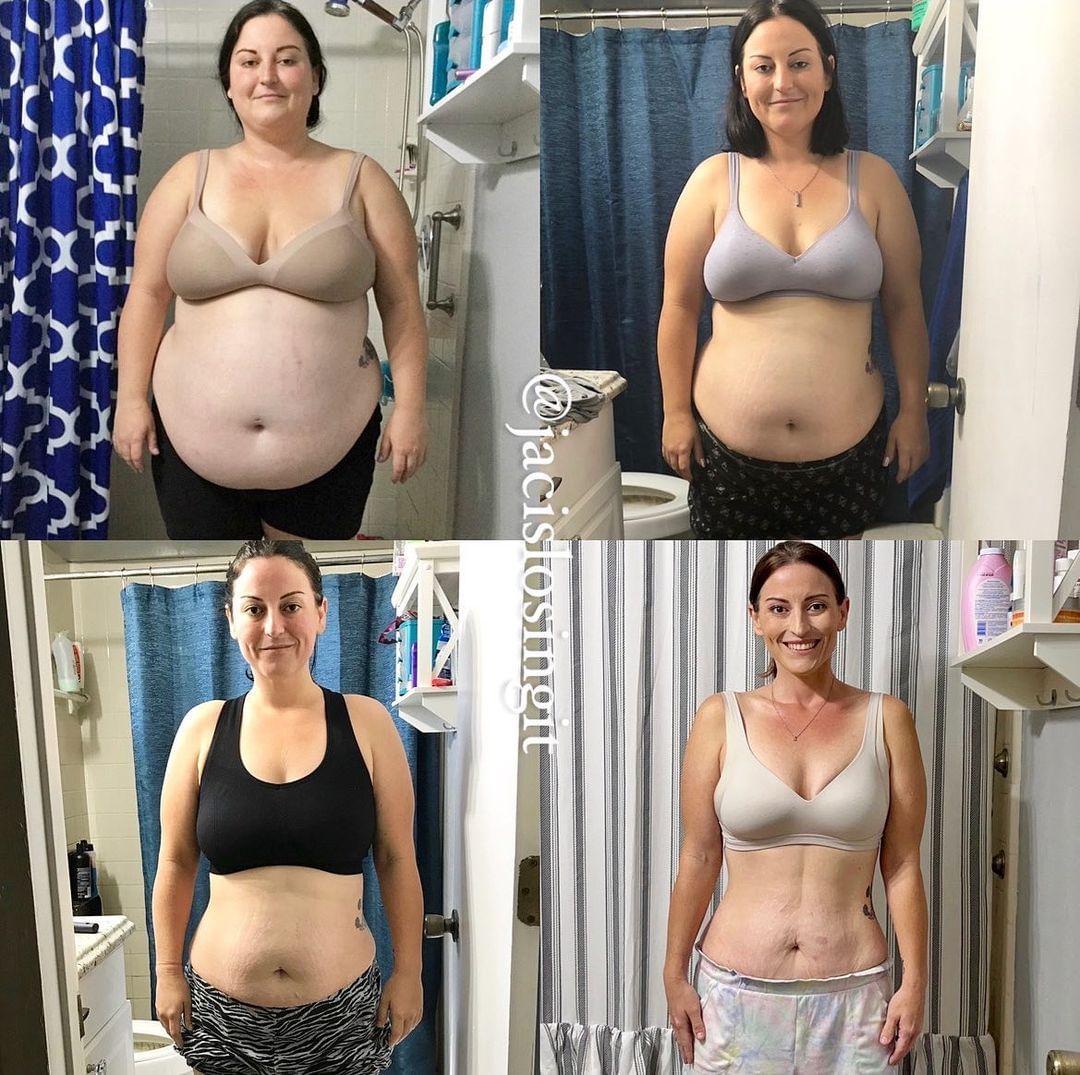 'Drop an ❤️ in the comments if you like this transformation 👇 _ ✨ 🆂🆃🅰🆁🆃 🆁🅸🅶🅷🆃 🅽🅾🆆 ✨ 👉 𝐋𝐈𝐍𝐊 𝐈𝐍 𝐁𝐈𝐎  for the best transformations 

 #ketoaf #easyketo #lowcarblove #ketomom #thenewhealthy #dietplans #healthyrecipe #todayfood #healthytips #healthyish