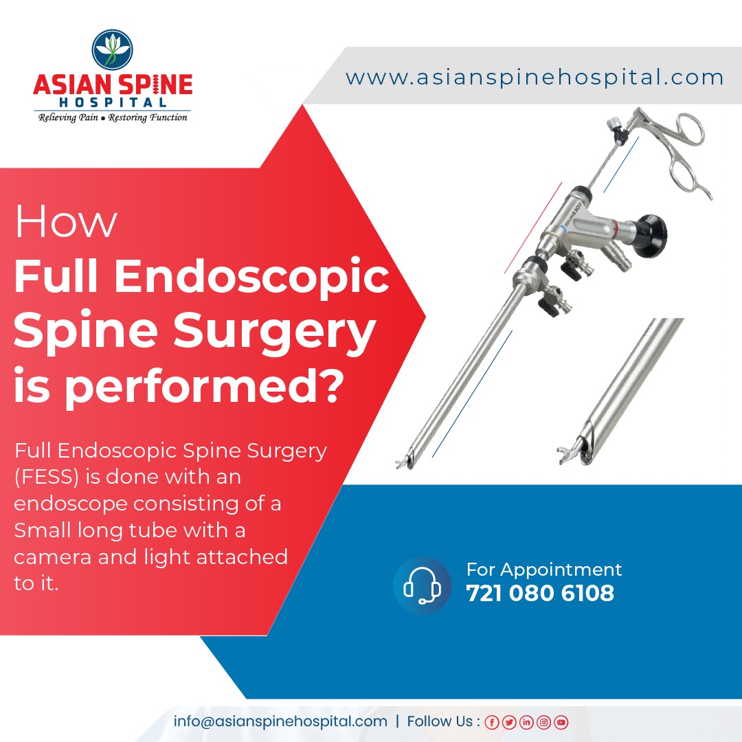 Asian_Spine's tweet photo. How Full Endoscopic Spine Surgery is performed? #spine #spinesurgey #spinesurgeon #endoscopicsurgery #fullendoscopicspinesurgery #spine #spinehealth #healthyspine #spinecare #spinehealthcare #backpain #lowbackpain #asianspine #asianspinehospital #healthcare #Workinjury #physio https://t.co/ICfWOqkV1T