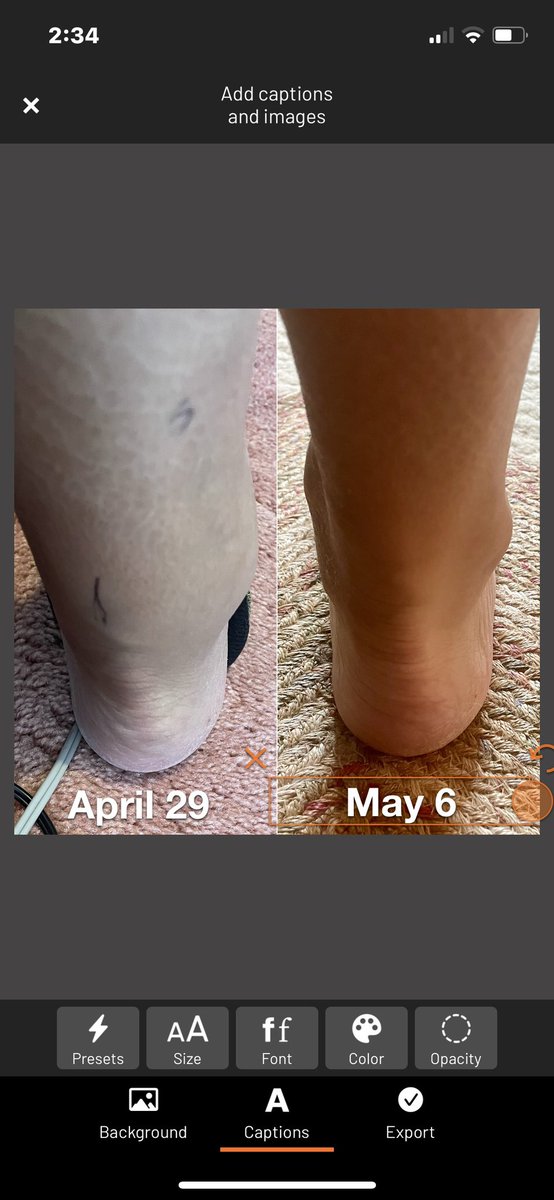 ToddCharnetski's tweet photo. Ankle tendon flare up. Hurt to walk. Took 7 days off from running. Not once did I ICE or take an NSAID or call a doc.
I stayed active, strengthened & used #MarcPro often. 2 days later added more walking. By May 10, I ran 7 miles pain free.
The body knows how to heal! Let it! https://t.co/HJ3LUUNc9e
