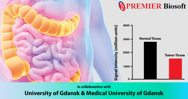 PREMIERBiosoft's tweet photo. @Uniwersytet_GD, Medical University of Gdansk, using @PREMIERBiosoft tools, SimLipid, illustrates differences between #CRC &amp; normal tissue #lipidome. https://t.co/4U1a2jjyov Kudos Alicja Pakiet, Kinga Sikora, Jarek Kobiela, Olga Rostkowska, Adriana Mika and Tomasz Sledzinski https://t.co/BFmQF2pE9q
