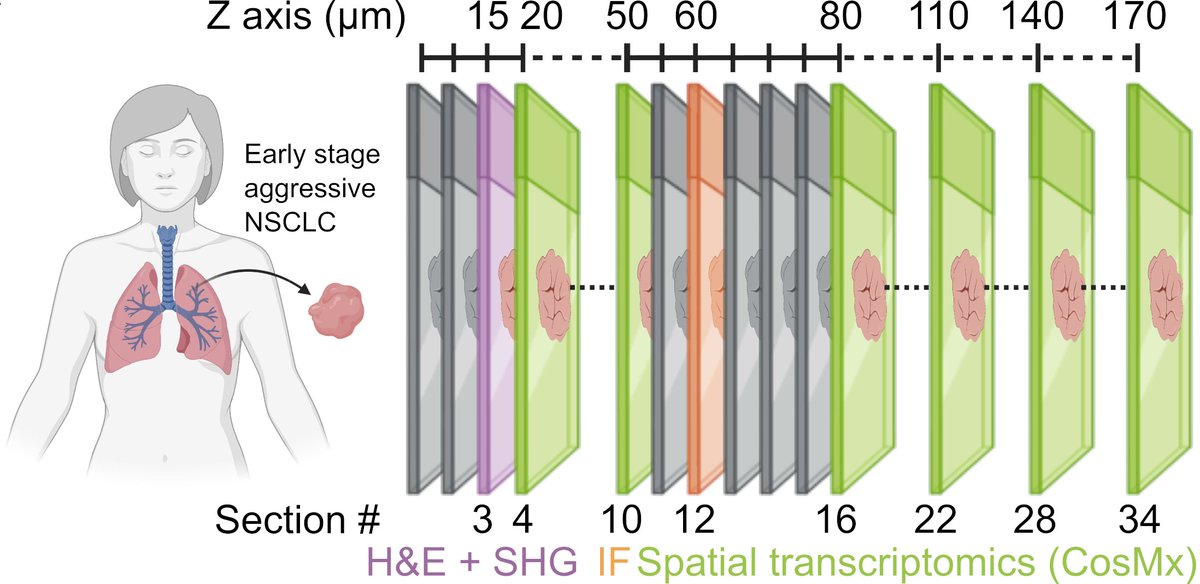 TMPentimalli's tweet image. 2/
For this proof-of-principle we focused on a routine FFPE lung cancer case (@FKlauschen @AIgnostics) and combined high-resolution spatial transcriptomics (CosMx @nanostringtech) with imaging-based readouts of tissue biomechanics (SHG) and protein markers (IF @CosciaLab)