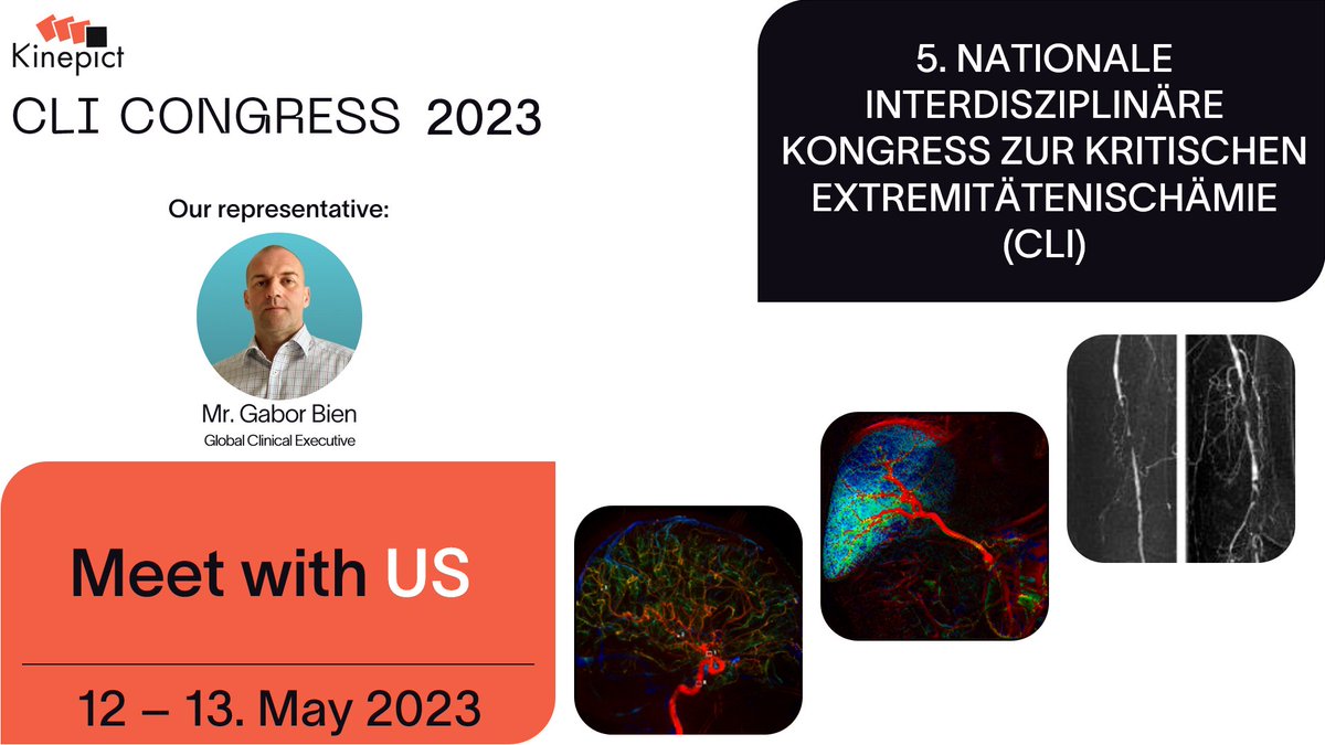 CLI congress starts on Friday and we will also be there!

We find it very important to prevent amputations and fight against CLI. 
Do you want to know, how? 
Ask our expert; Mr. Gabor Bien!
More information on the congress:bit.ly/3LJoOJn

#cli #amputationprevention