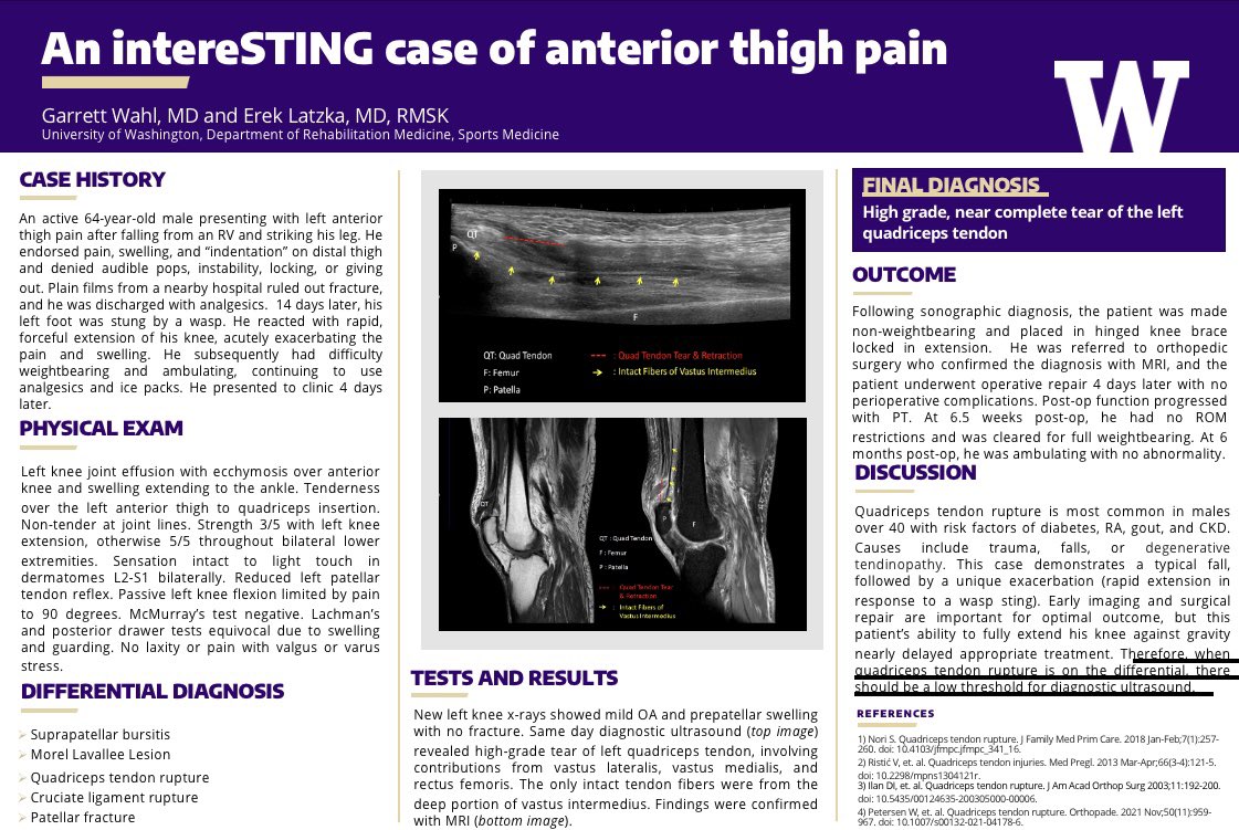 ErekLatzkaMD's tweet image. Catching up on #AMSSM2023. New record of 7 case reports with UW residents and fellows this year. Best title by far: “O’ Elbow, How Came’st Thou in This Pickle” by our chief @KSmo_DO 

@UWRehabMed @TheAMSSM #shakespeare #sportsmedicine #mskultrasound #mskrad