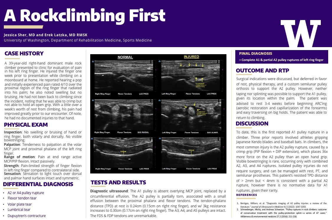 ErekLatzkaMD's tweet image. Catching up on #AMSSM2023. New record of 7 case reports with UW residents and fellows this year. Best title by far: “O’ Elbow, How Came’st Thou in This Pickle” by our chief @KSmo_DO 

@UWRehabMed @TheAMSSM #shakespeare #sportsmedicine #mskultrasound #mskrad