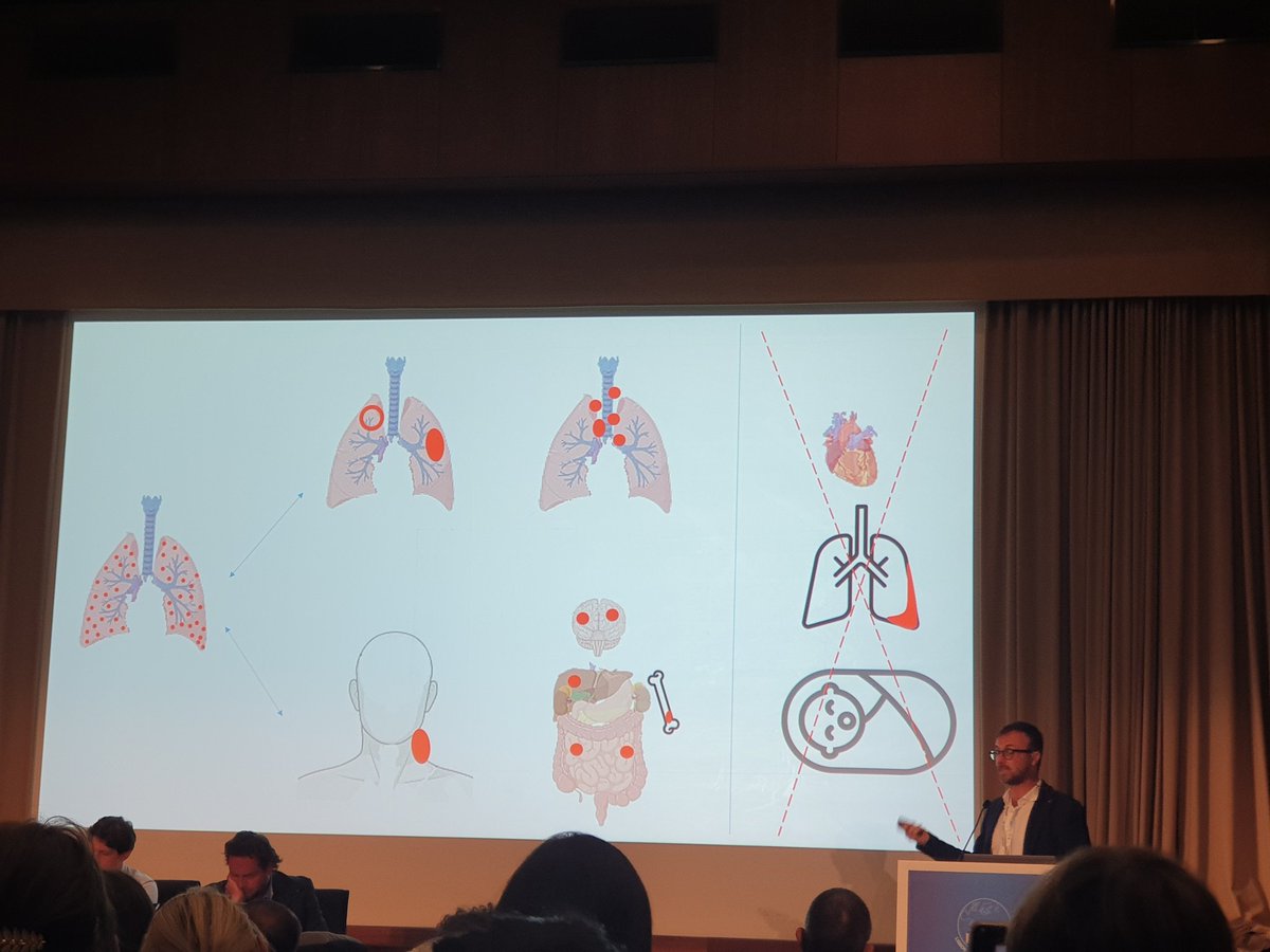 DaelemansSiel's tweet photo. Great presentation of a pTBnet study about Miliary TB from my friend and collegue @surf4children #ESPID2023 @ESPIDsociety https://t.co/ieCREfZREV
