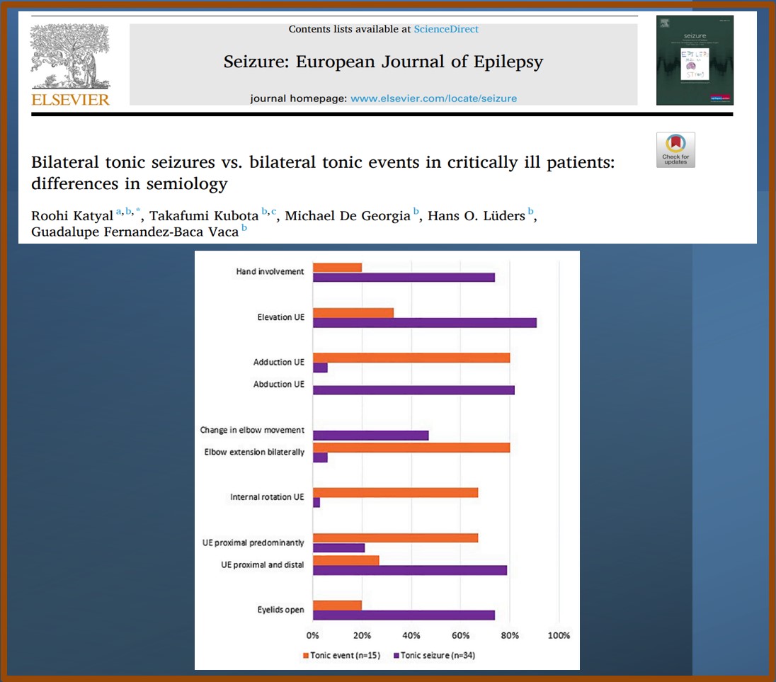 Roohi Katyal (@roohikatyal) on Twitter photo "š¤ Epileptic or non-epileptic?" Can you tell the difference in semiology between bilateral tonic seizures & non-epileptic tonic events in ICU patients? š Check out our study highlighting the main differences! š <a href="/guadalupefbv/">Guadalupe Fernandez-Baca Vaca</a> <a href="/SeizureJournal/">Seizure Journal</a>
authors.elsevier.com/a/1h3Dv3mqOkMs⦠"š¤ Epileptic or non-epileptic?" Can you tell the difference in semiology between bilateral tonic seizures & non-epileptic tonic events in ICU patients? š Check out our study highlighting the main differences! š <a href="/guadalupefbv/">Guadalupe Fernandez-Baca Vaca</a> <a href="/SeizureJournal/">Seizure Journal</a>
authors.elsevier.com/a/1h3Dv3mqOkMsā¦