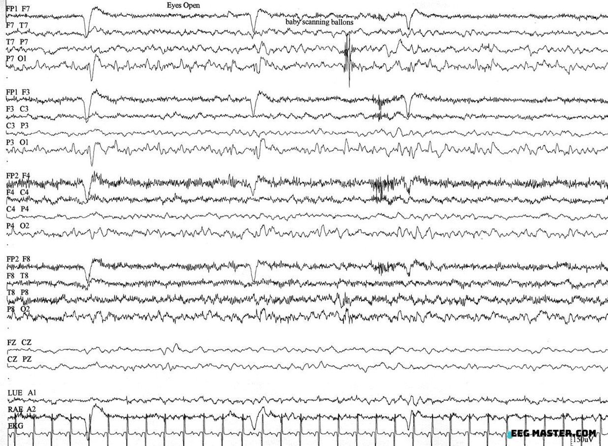 EEG Master (@eeg_master) on Twitter photo 2023-05-11 20:10:17