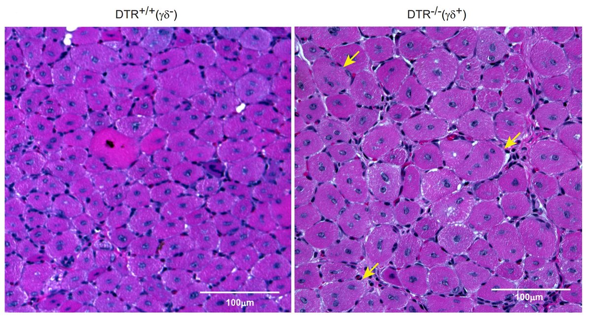 Zhijuan Qiu (@zhijuan_jexpmed) on Twitter photo For this month's #JEM_Spotlight, we revisit the study by Diane Mathis, Alexander Mann, <a href="/bolahanna/">Bola Hanna</a> & colleagues <a href="/harvardmed/">Harvard Medical School</a> showing IL-17A–producing γδT cells promote muscle #regeneration in a #microbiota-dependent manner. bit.ly/3LFrwy7
#gdTcells For this month's #JEM_Spotlight, we revisit the study by Diane Mathis, Alexander Mann, <a href="/bolahanna/">Bola Hanna</a> & colleagues <a href="/harvardmed/">Harvard Medical School</a> showing IL-17A–producing γδT cells promote muscle #regeneration in a #microbiota-dependent manner. bit.ly/3LFrwy7
#gdTcells