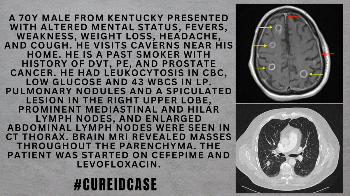 id_cure's tweet photo. #CUREIDCase
Find more details on CURE ID that will help you make the correct diagnosis: https://t.co/UCZrQvs6li
#IDTwitter #IDMedEd #MedEd #IDCase #CUREID https://t.co/GP9EXeCK1C