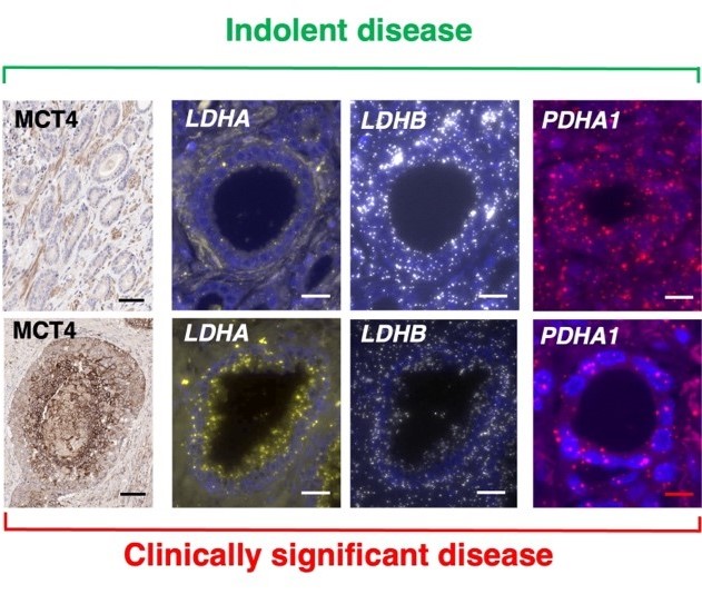 Indica_Labs's tweet photo. Missed our April 6 webinar with Nikita Sushentsev and Cara Brodie on how they used multiplex IHC, #RNAscope, and tissue classification in their recent paper? Click to watch the recording!
https://t.co/M6k5MbZxb5
#digitalpathology #AdvancingYourRNAISH #HALOimageanalysis https://t.co/5Nf3QCeBLq