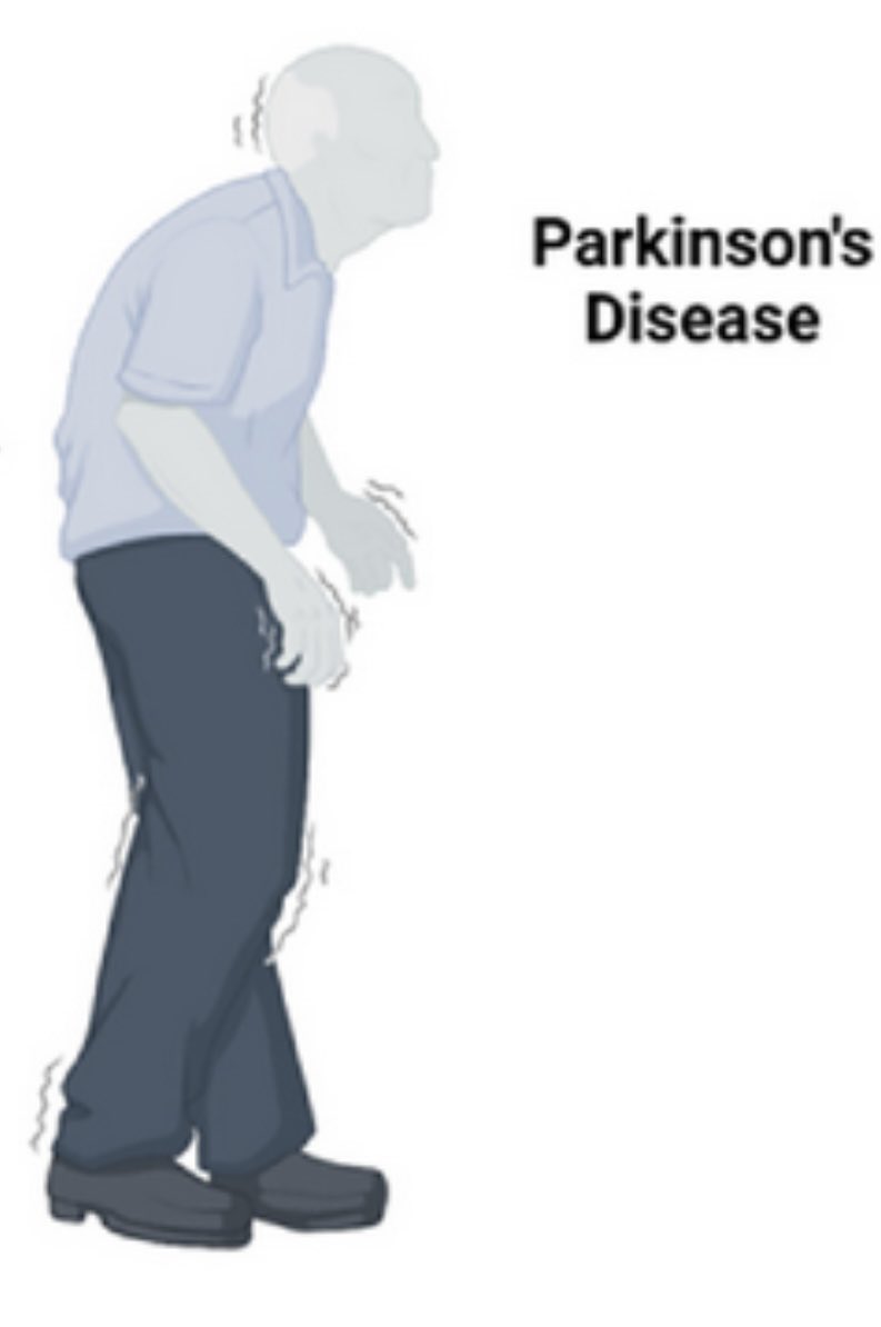 Kunath Lab on Twitter "Hey authors, editors, and reviewers of Parkinsons manuscripts… can we