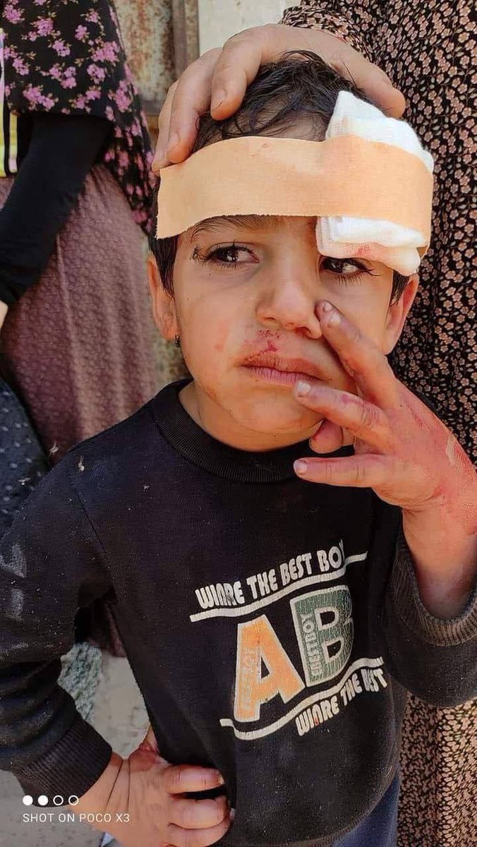 SarahHamdan25's tweet photo. What did this child do? 

This is an evidence to #IsraeliCrimes in Gaza.

The whole world must stand to support #Gaza. https://t.co/x88bz1EnvK