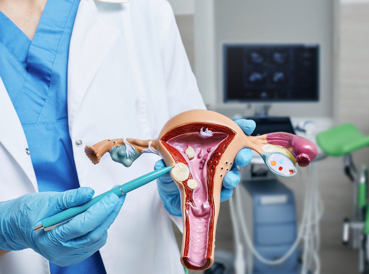 #FDA-approved drug combos to treat uterine fibroids without surgery! They help with heavy periods, pain relief and decrease the need for a hysterectomy. #UterineFibroids #women #health #twitter #TrendingNow #NowStreaming