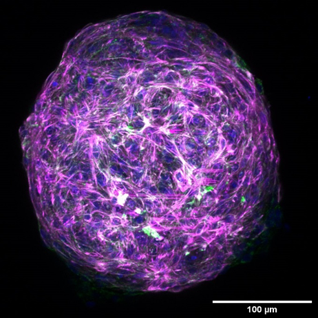 Congrats to @bdcoffin for winning the @cmu_mse department's Krivobok Brooks Award for best research image!!! Gotta love a 3D image of an iPSC-derived cardiac spheroid!