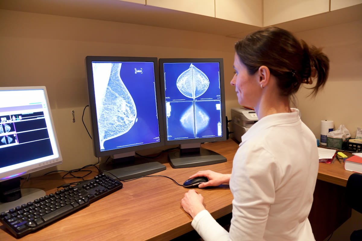 Do  the New #USPSTF Recommendations Go Far Enough on #Mammography Screening? ow.ly/uHBu50Om5UR @ACRRFS @ACRYPS @RadiologyACR @ARRS_Radiology @SBIRFS @BreastImaging @DukeRadiology @PennRadiology @YaleRadiology @BrighamRad @UABRadiology @EmoryRadiology #radiology #RadRes