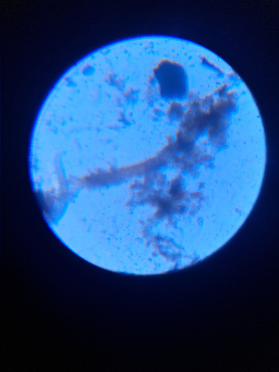 Vermicompost/ bokashi mix @ 300x

#soilbiology #soilscience #soiltest #microbiology #microscopy #SoilHealth 
#regenerativeagriculture #regenerativesoil