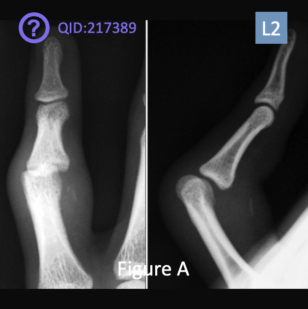 Orthobullets tweet media