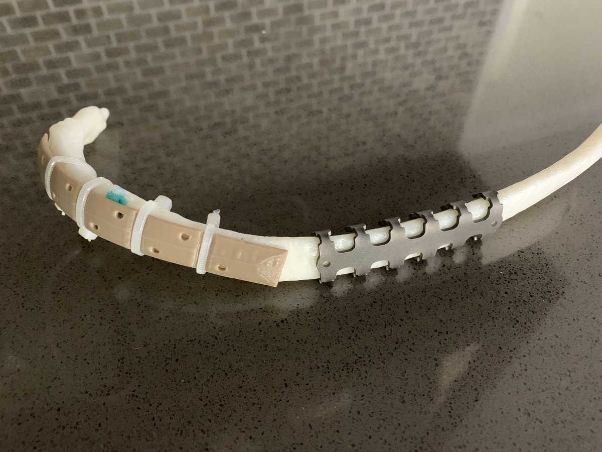 how about plastic prosthetics affixed with cable ties?