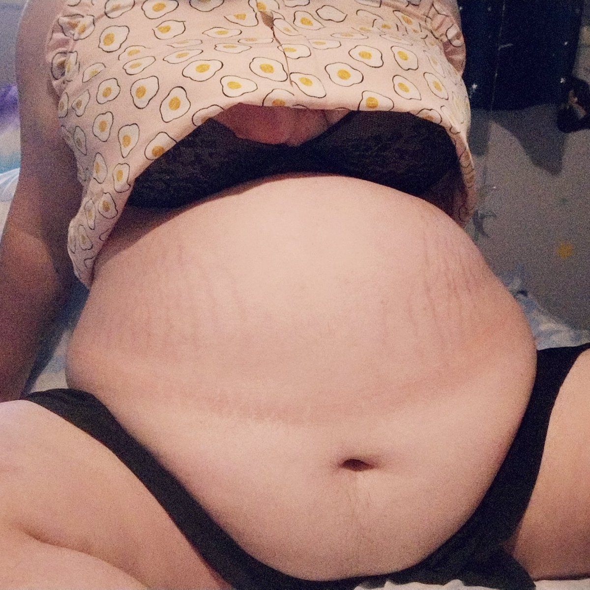 420gainerpiggy's tweet photo. Oops! Guess my cute new skirt couldn't withstand the weight of my big fat belly! 🐷🥰

#fat #fatty #gainer #feeder #feedism #bellykink #transfeedee #bigbelly #fatslut #fatfetish #fatbelly #feedme #nsfwtwt #bbw #nsfwbbw #lookingforfeeder #fatporn #fatass #sub #submissive #feedee https://t.co/jznO1atKvZ