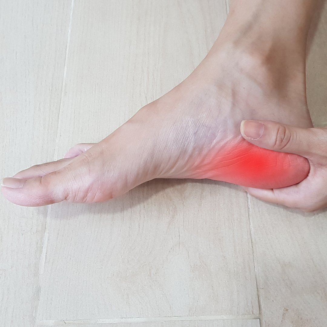 Flawless_Physio's tweet photo. 📖 Activity and footwear characteristics in people with and without plantar heel pain: A matched cross‐sectional observational study: 2023  

📕:https://t.co/FYzyyuJTXP

🧵 Summary below: 1/5 https://t.co/bqABhaDon1