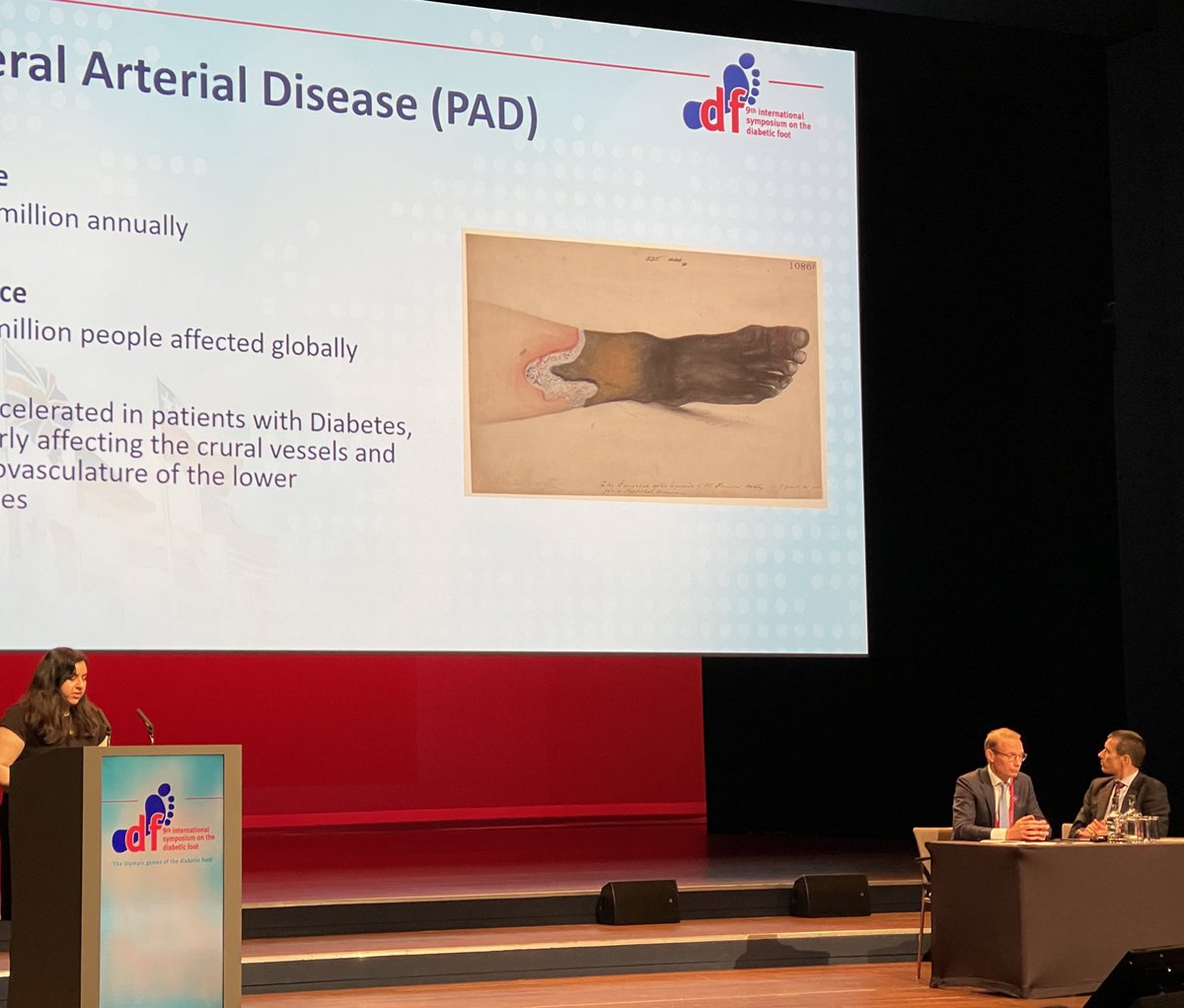manalvascular's tweet image. Delighted to present at #isdf2023 in The Hague @ImperialVasc