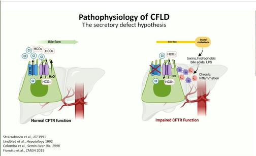 EASLedu's tweet photo. Challenging the current view of the cyctic fibrosis related liver disease #EASLMono
👉Moving from the secretory defect hypothesis to a gut-liver hypothesis
@EASLNews
#LiverTwitter #CFLD https://t.co/IPGwEIR3AW