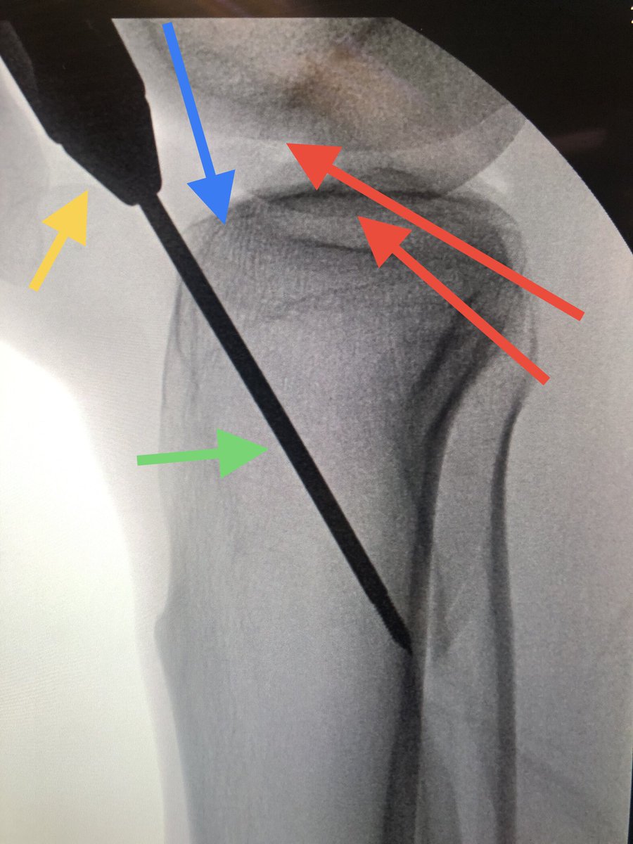 Yelena Bogdan, MD, FACS, FAAOS tweet media