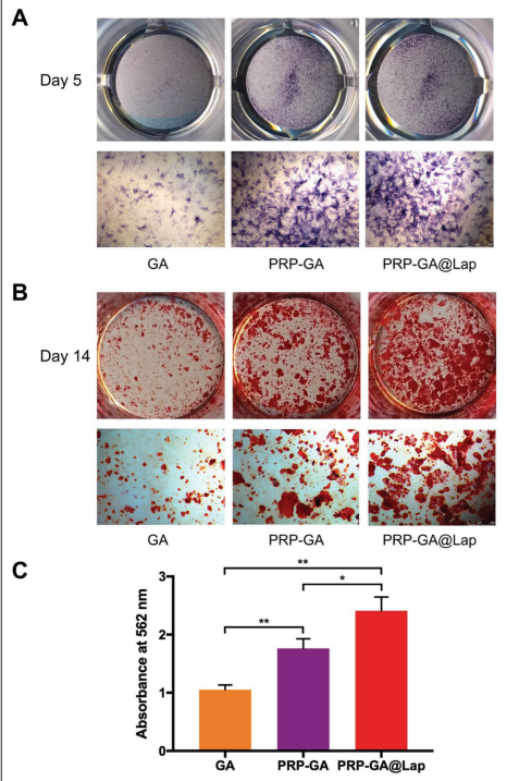 IJB_ASP's tweet image. Do you know 3D-printed #biofunctional #scaffolds have promising applications in #bone #tissue regeneration?🤔🤔
Please read this article:3D-printed vascularized biofunctional scaffold for bone #regeneration

Read more:👇👇
ijb.sg/index.php/int-…