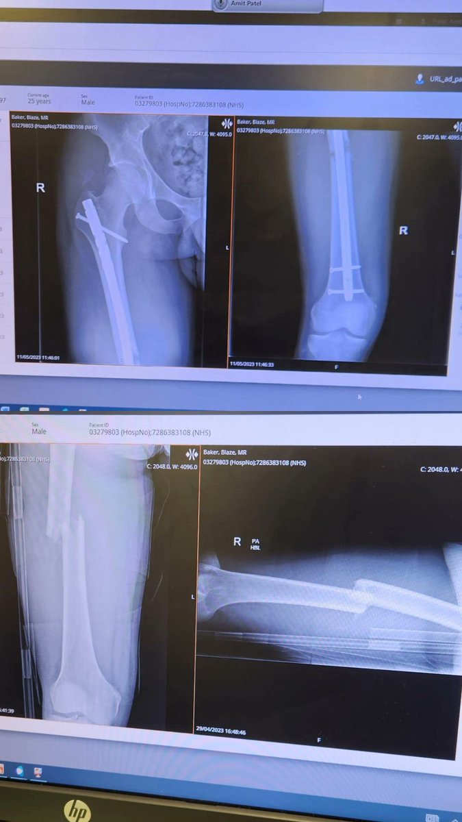 Blaze Baker tweet media