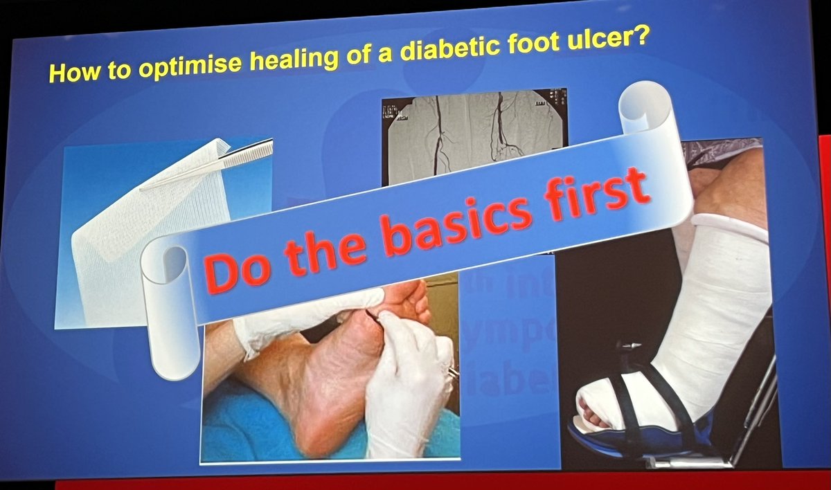NielsEjskjaer's tweet image. 3rd #ISDF2023 Morning Symposium, great overviews, great value👍

#DanZiegler Neuropathy = “early complication”
@Franers13 Basics optimise healing
#BorisMankovsky Riveting Diabetes Wartime Report
(Live from 🇺🇦Ukraine)

#StenoNord #SDCN @AalborgUH @DiabResearch @UHDBTrust @Reg_Nord