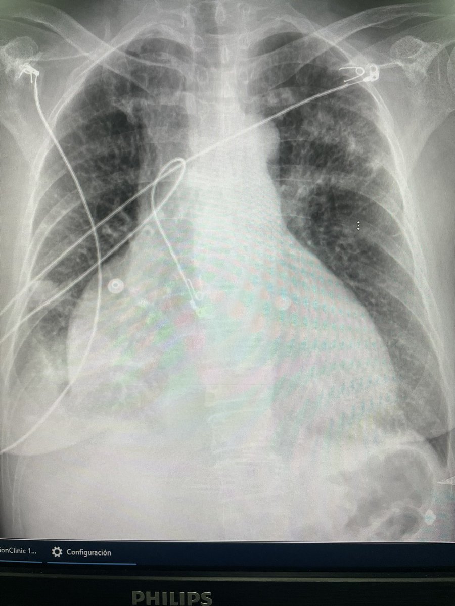 Alberto Hidalgo tweet media