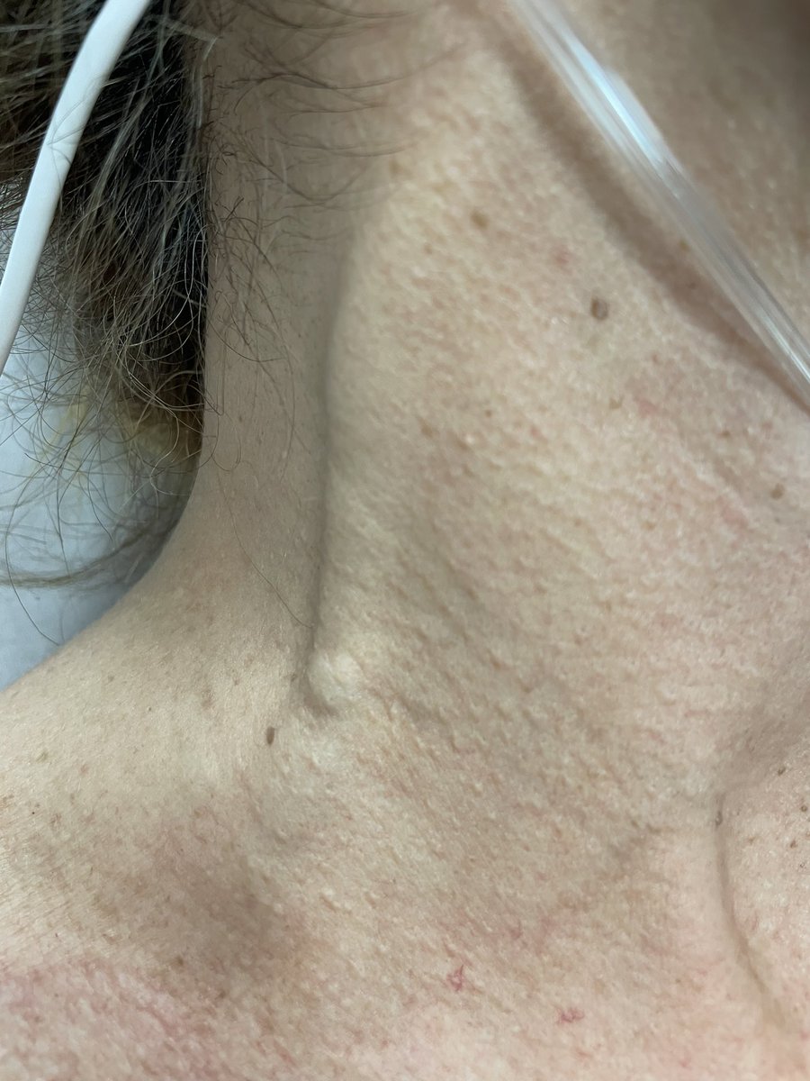 Alberto Hidalgo tweet media