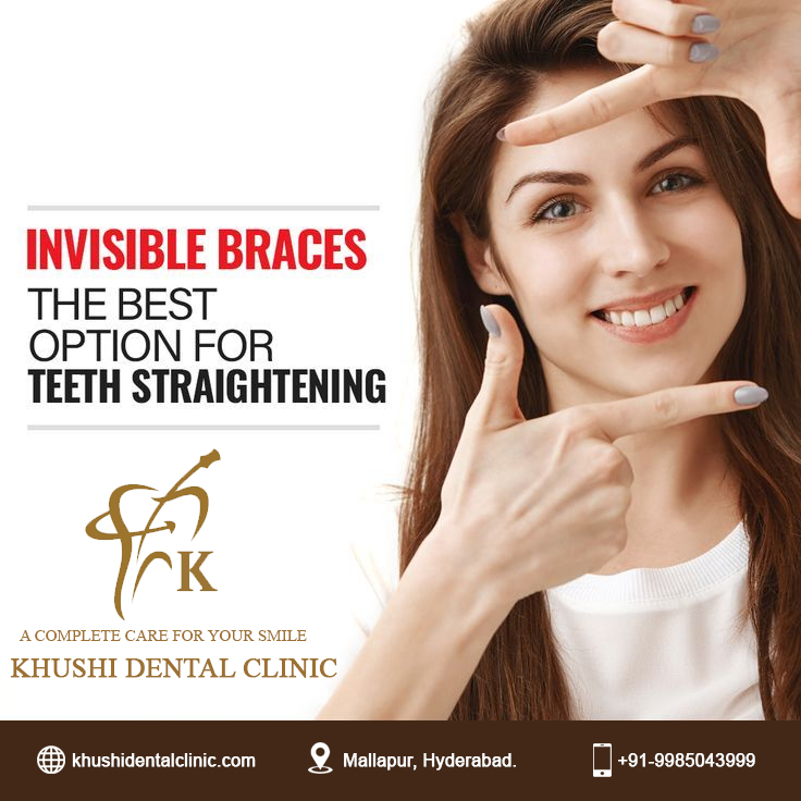 #InvisibleBraces #ClearAligners #StraightTeeth #SmileTransformation #NoMoreMetalBraces #ConfidentSmile #ClearChoice #InvisibleResults #OrthodonticTreatment #PerfectSmile