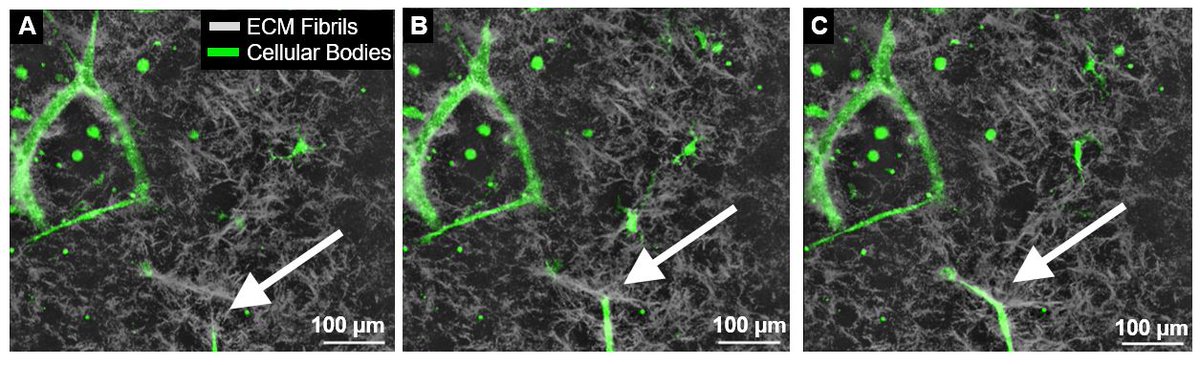 Pleased to share our paper quantifying influence of local biophysical cues on guidance of sprouting angiogenic microvessels.  Co-lead authors are recently minted PhD <a href="/UtahBME/">UtahBME</a> <a href="/adam_rauff/">Adam Rauff, PhD</a> and former undergrad Jason Manning. link.springer.com/article/10.100…
pdf:  tinyurl.com/4w7h77me