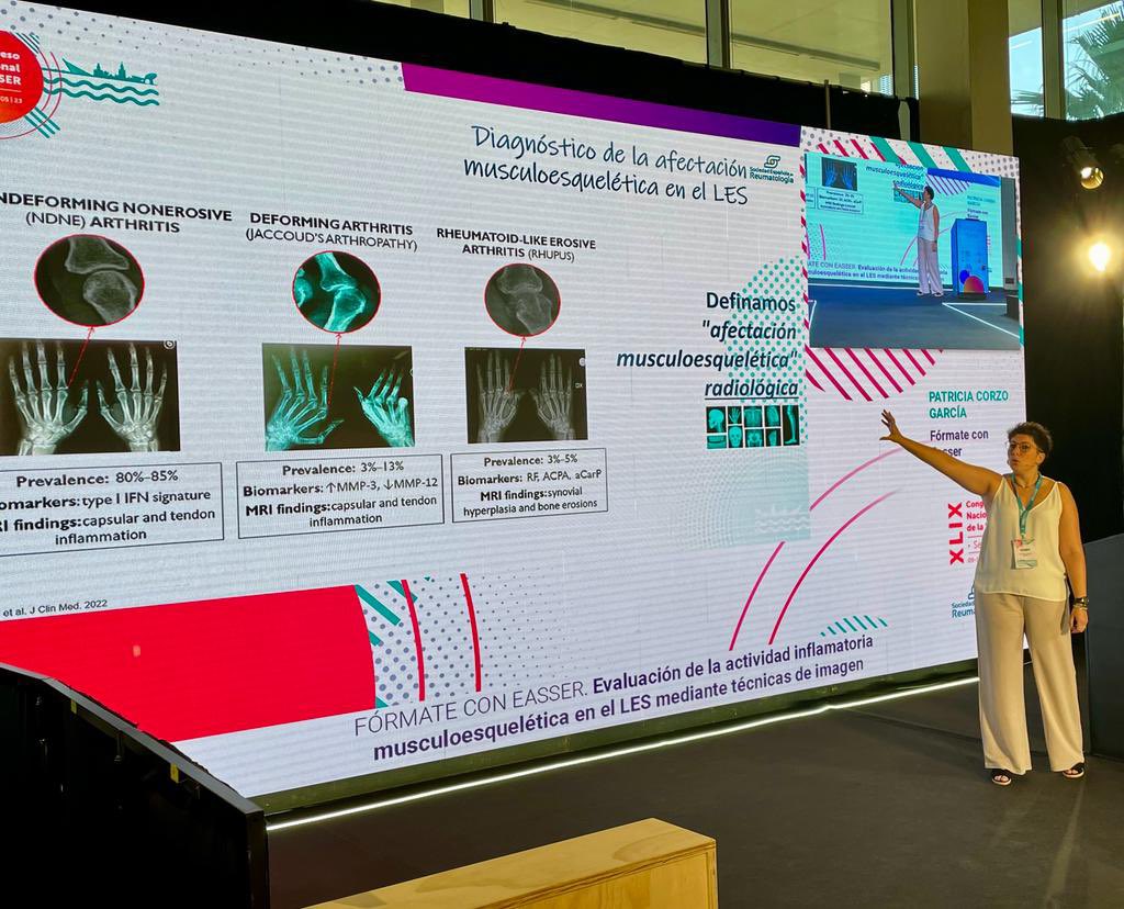 Reumaclinic's tweet photo. Tercera jornada del congreso de la @SEReumatologia con la participación de @Reumaclinic en diversas áreas del conocimiento
-Básica: Membrana sinovial por @abazuaga
- Imagen en Lupus por @PatriCorzo y
- Metabolismo óseo por Ana Monegal
#SER2023 #sinovitis #Lupus #osteoporosis https://t.co/rivHk0aT9p