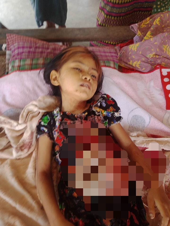 ယင်းမာပင်မြို့နယ်တွင် စစ်တပ်က အသက် ၆ နှစ်အရွယ် ကလေးငယ် ၁ ဦးအပါအဝင် ပြည်သူ ၅ ဦးကို ပစ်သတ်ပြီး ငွေကျပ်သိန်း ၂၀၀ ​ကျော် ခိုးယူသွား
Read more->yktnews.com/2023/05/%e1%80…