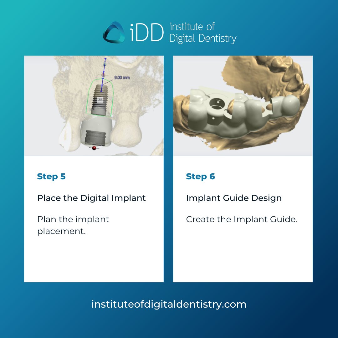 Want to see the last steps or get a more in-depth explanation? 

Check out our digital implantology courses available on our website plus bonus content.

digitaldentistry.link/digitalimplant…

#idd #digitaldentistry #digitalimplantology #dentalimplants #guidedimplantsurgery #digitalimplants