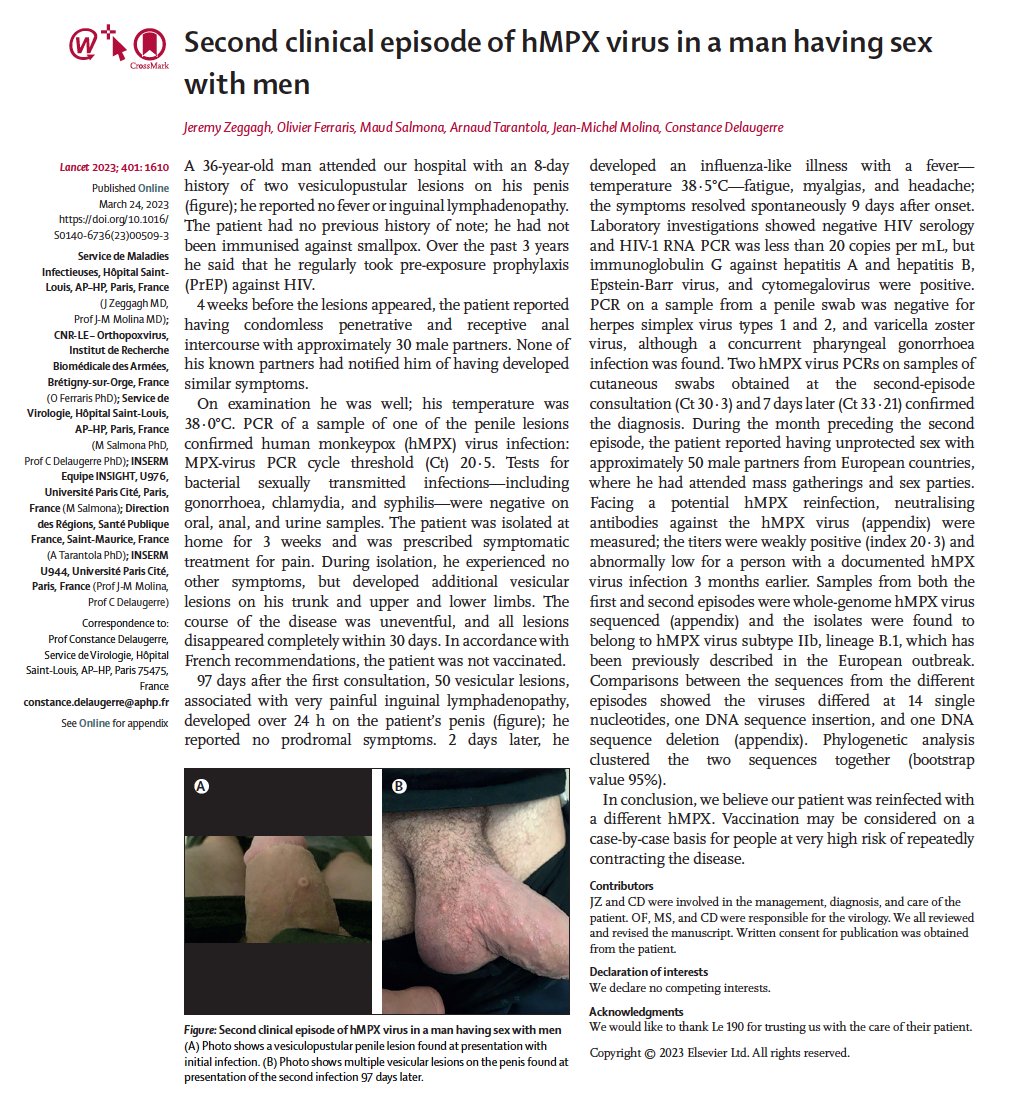 BogochIsaac's tweet photo. Case report of a person re-infected with mpox (formerly monkeypox) in France.

This person was unvaccinated &amp; did not appear to be immunocompromised.

Mpox should still be on the differential diagnosis in those previously infected.

https://t.co/5Q81eWwCVl https://t.co/B5Mroe5b6G